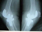 coimbatore-orthopaedic-joint-replacement-maternity-child-welfare-centre-india